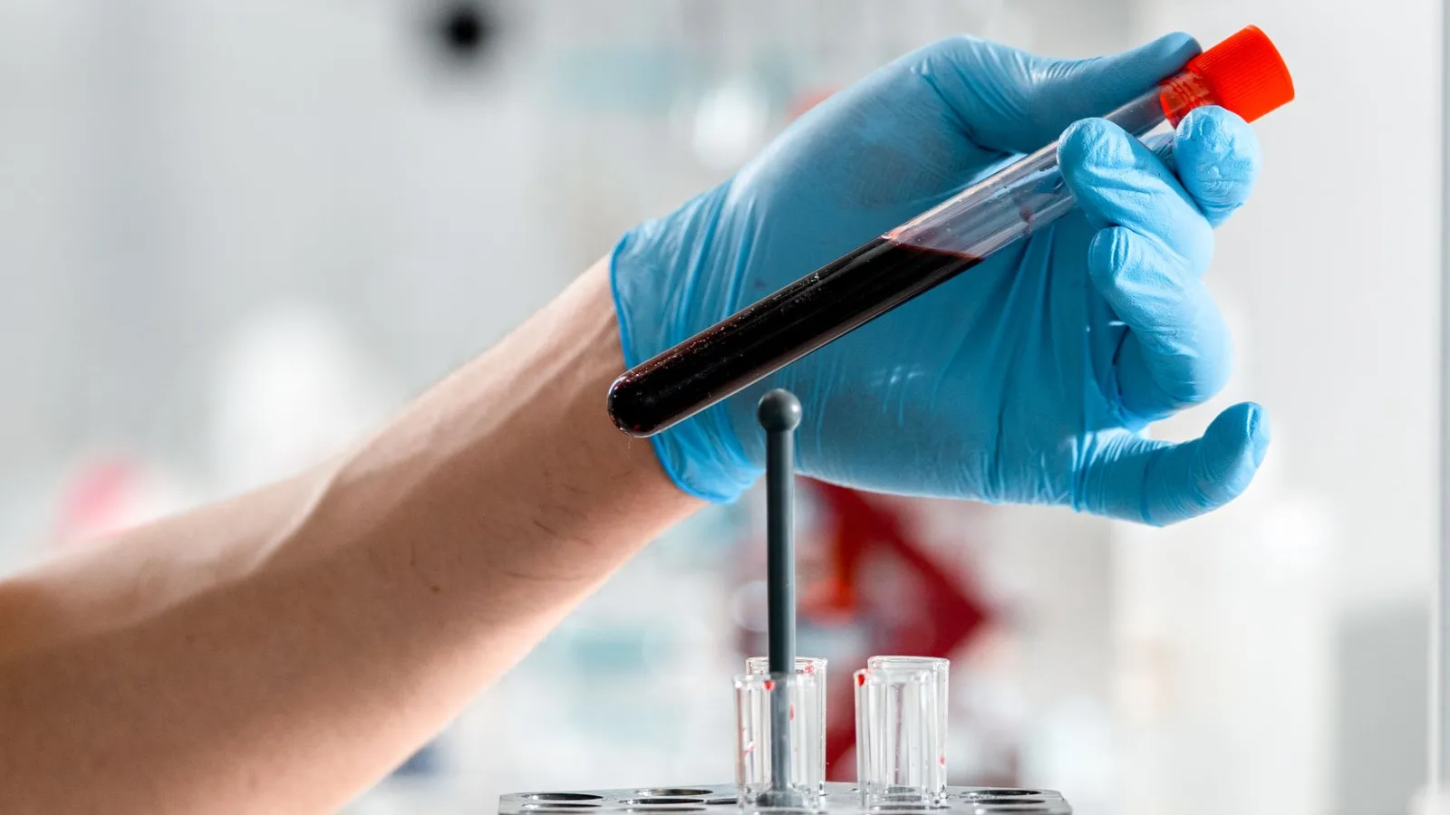 Close-up of a gloved hand holding a test tube with blood sample in a clinical research lab.
