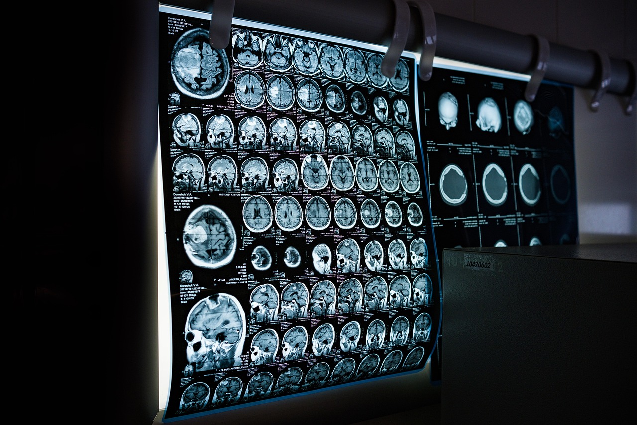 Record NHS spend on private scan reporting raises fresh alarms over staffing and standards